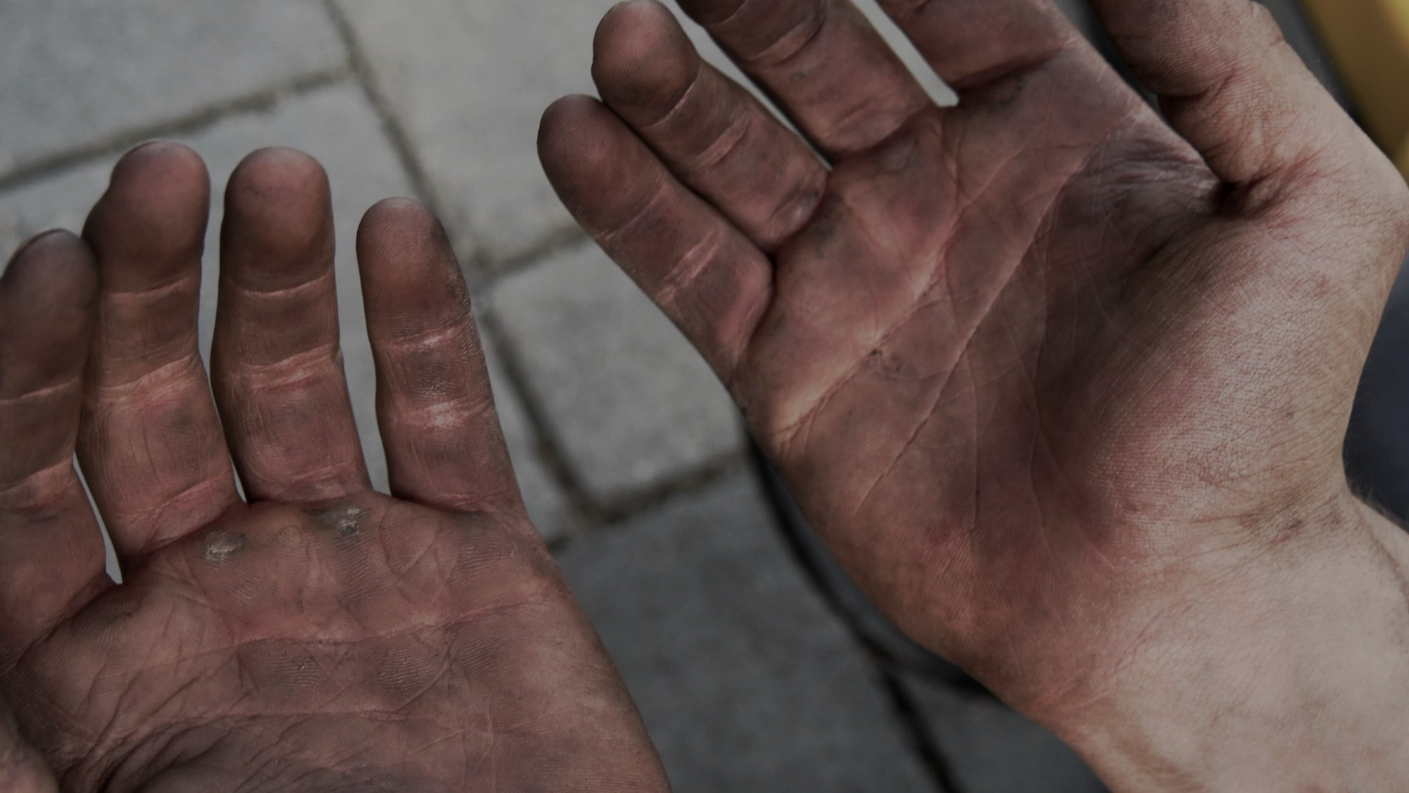 Open, work-worn hands after a day of labor